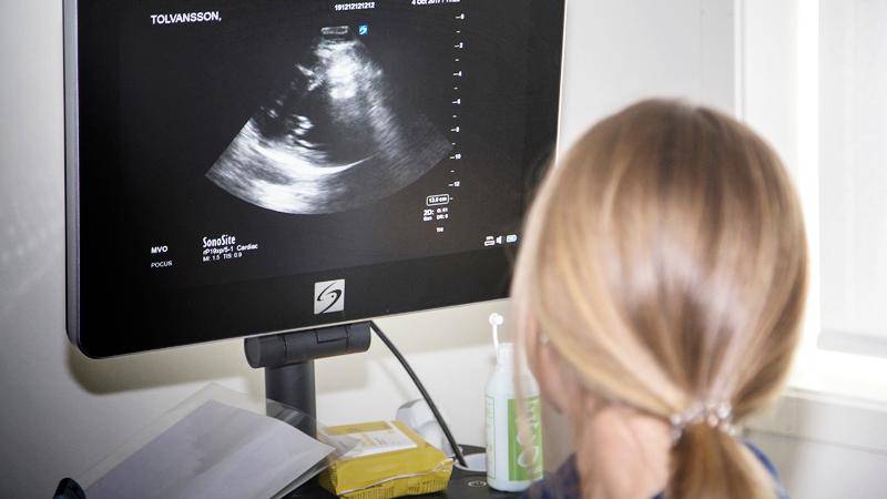 20170613 - Sjuksköterska tittar på skärm som visar ultraljud på St Görans sjukhus i Stockholm.Fotograferna Holmberg / TT / kod 96