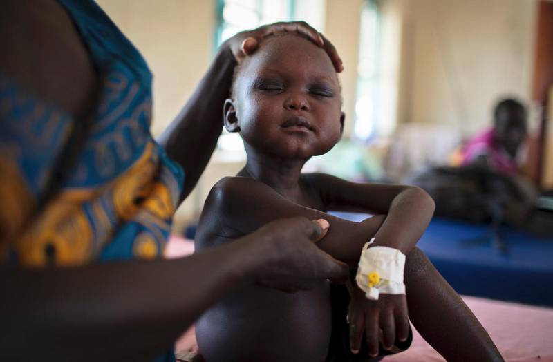 HUNGER. Fyraårige Josep Atak är en av många undernärda barn i Sydsudan, som här får hjälp på ett sjukhus. Sydsudan är indraget i ett förödande inbördeskrig, och tidigare i somras rådde det svält i vissa delar av landet, utifrån FN:s strikta definitioner. FN varnade i mars för att 20 miljoner människor riskerar att svälta ihjäl i år, då en omfattande svältkatastrof riskerar att bryta ut. Varningen gäller fortfarande, och flera länder befinner sig i dagsläget på randen till svält, berättar Anne Poulsen, från FN:s livsmedelsprogram.