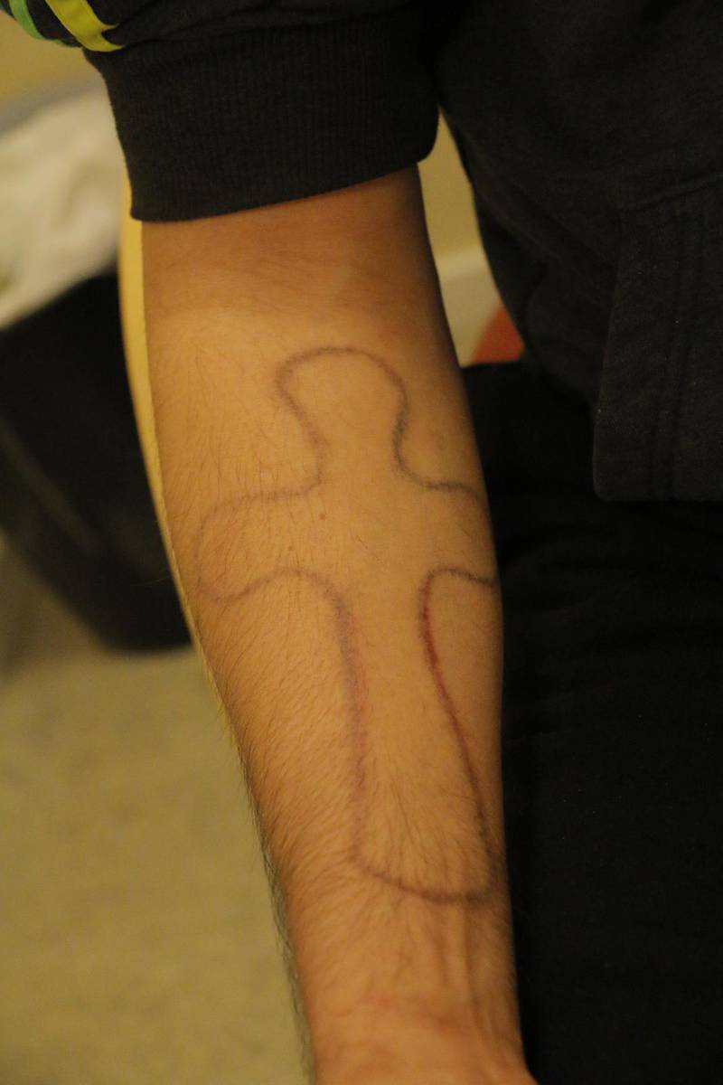 Hossein har ristat in ett kors på underarmen.