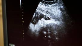 Föreningen Människovärde: Abort avslutar alltid ett liv